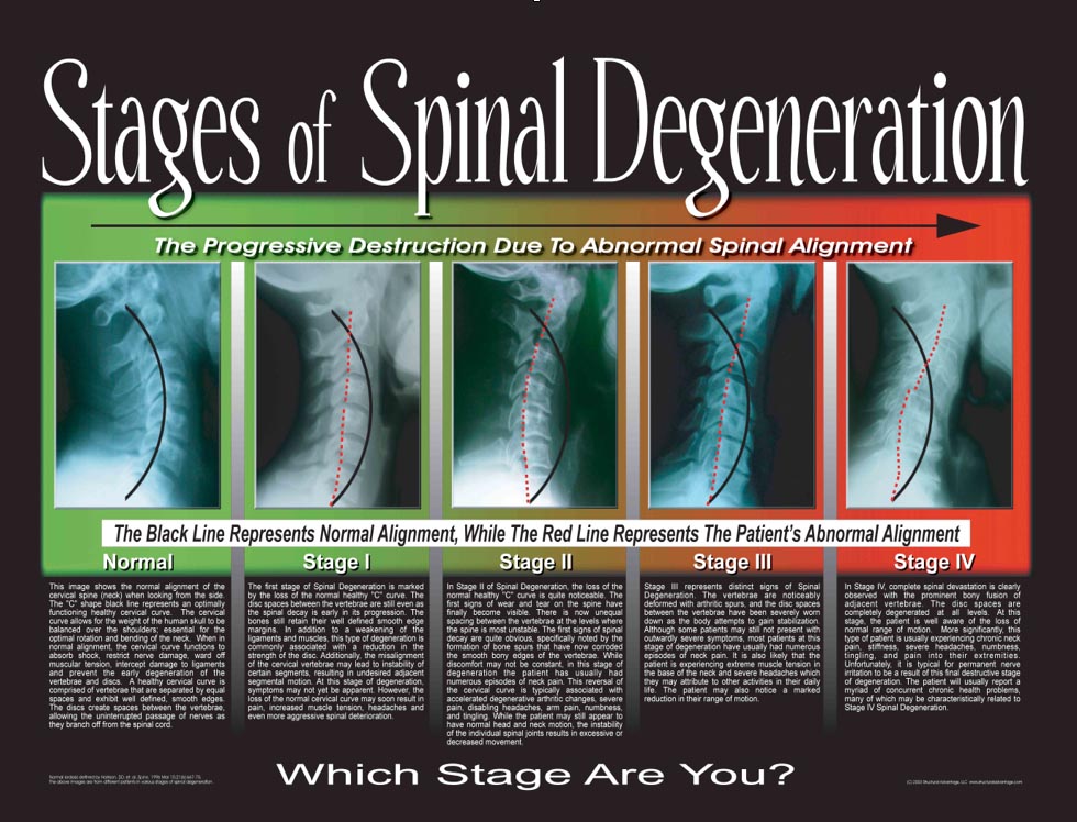 chiropractic spine alignment